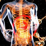 régime pauvre FODMAP